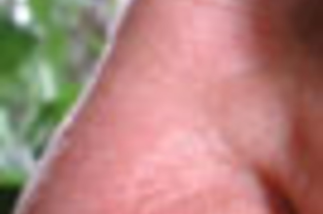 nose_SM