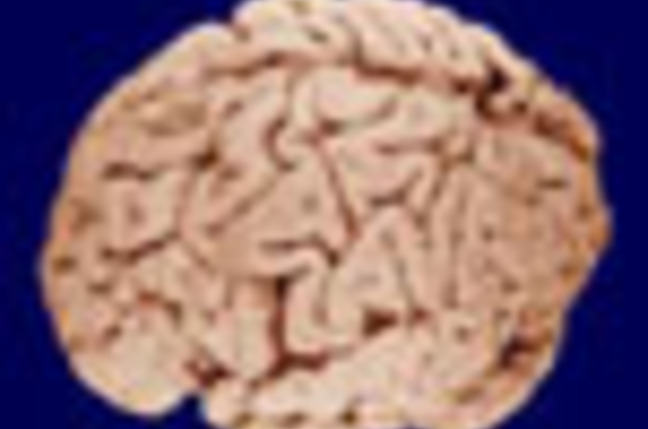 human_brain_02_sm