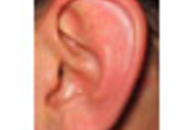 Human_ear_SM