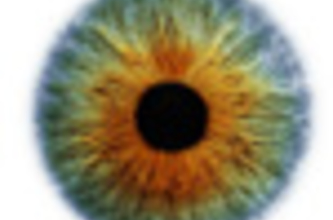 Eye