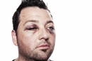 Blackeyes, image via Shutterstock