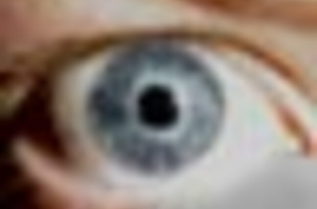 Eye