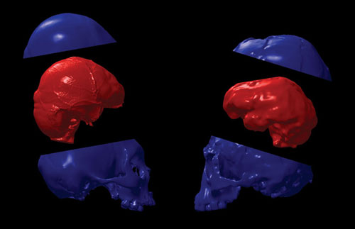 Modern microcephalic, left and LB1, right