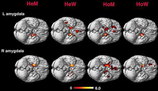 Amygdala activity in heterosexual men and women (HeM and HeW) and homosexual men and women