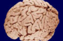 Human_brain_SM