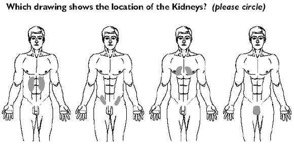 Four possible locations of the kidneys