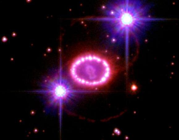 The 'String of Pearls' around remnants of supernova 1987A in the Large Magellanic Cloud. Credit: CU-Boulder