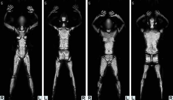 Example imagery produced by AIT millimetre wave airport scanner. Credit: TSA