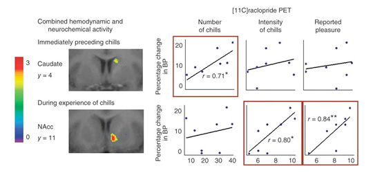 Anatomically distinct dopamine release during anticipation and experience of peak emotion to music