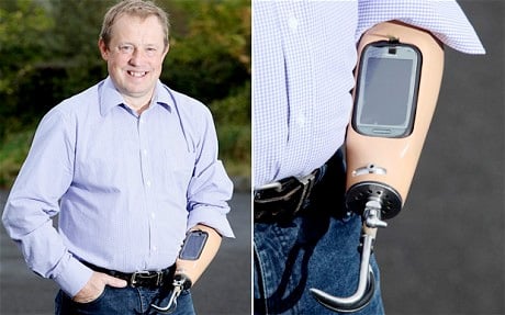 Trevor Prideaux's prosthetic smartphone arm