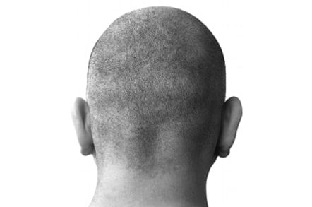 back of man's shaved head