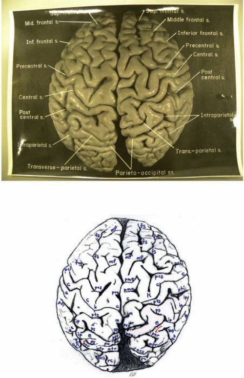 One of the newly-uncovered photos of Albert Einstein's brain