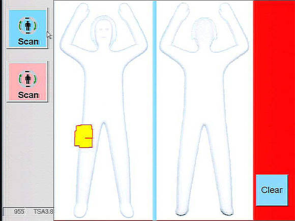 Screenshot of body-scanner Automated Target Recognition in action