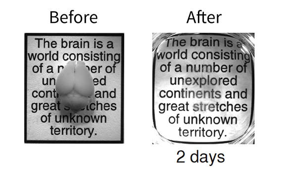 Before and after photos showing a brain made transparent using the CLARITY technique