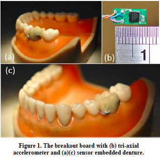 Tooth implant