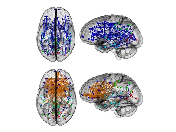 DTI scans of male and female brains, showing pathways