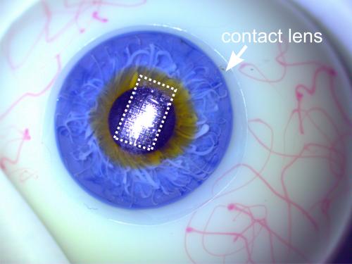 Circuit on artificial eye