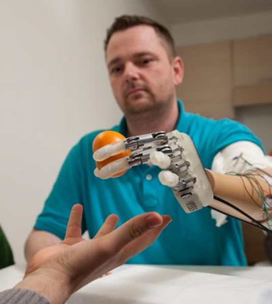 A prosthetic hand with a sense of touch