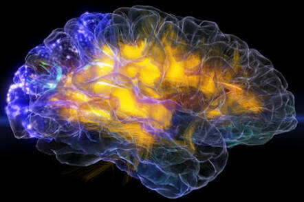 "Image from the glassbrain project, neuroscapelab.com, UCSF