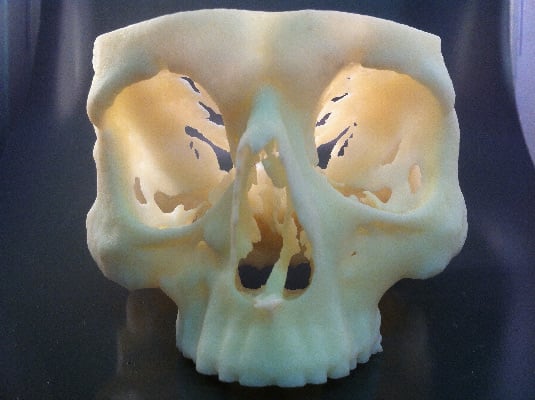 Sacnned and printed in 3d skull