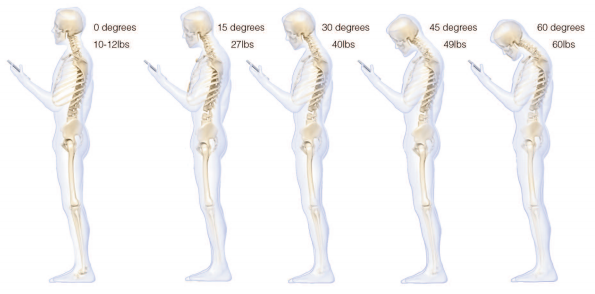 How TXTing stresses your spine