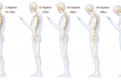 How TXTing stresses your spine