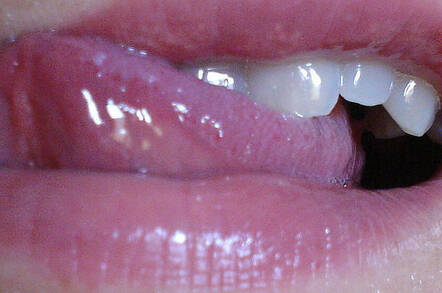 Tongue