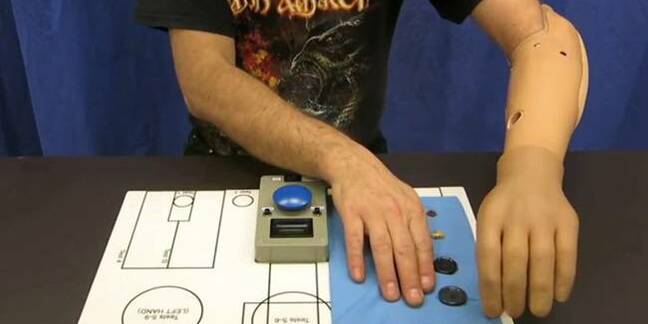 bionic hand