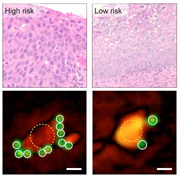 MGH's microbead diagnostics