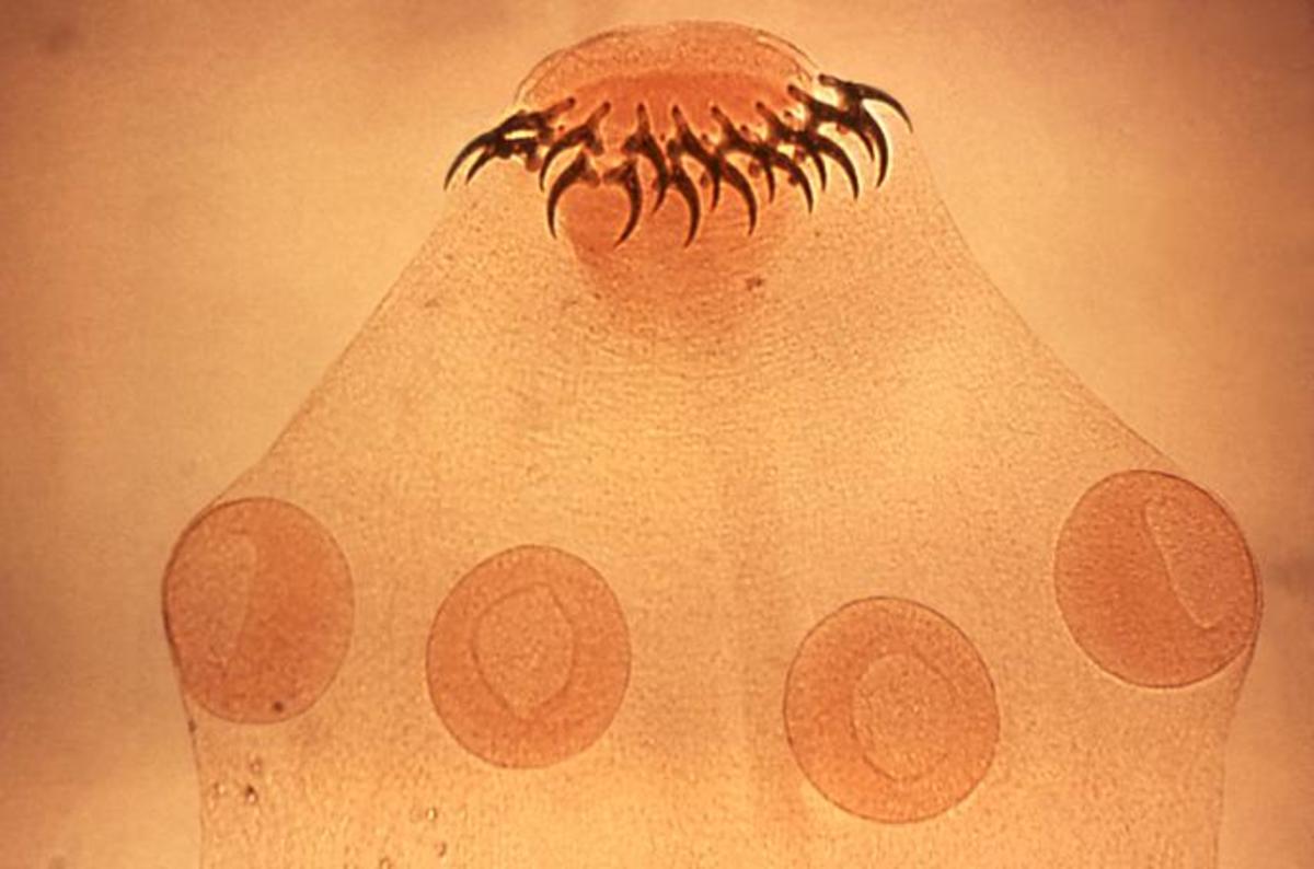 characteristics-of-a-tapeworm