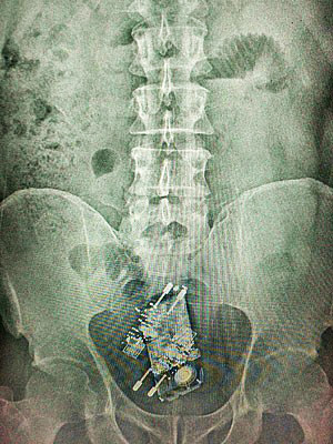 The X-ray showing the mobile phone and two chargers