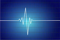 Heartbeat graph