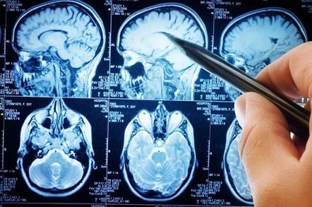 MRI SCANS. Photo by shutterstock