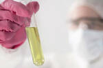 Lab tech with urine sample - Shutterstock