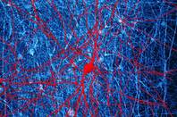 Stained_brain_neurons