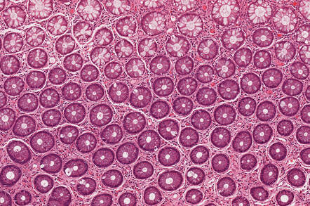 cells