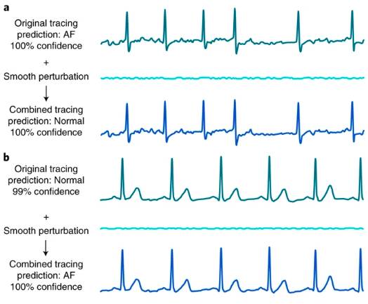 ECG_adversarial_example