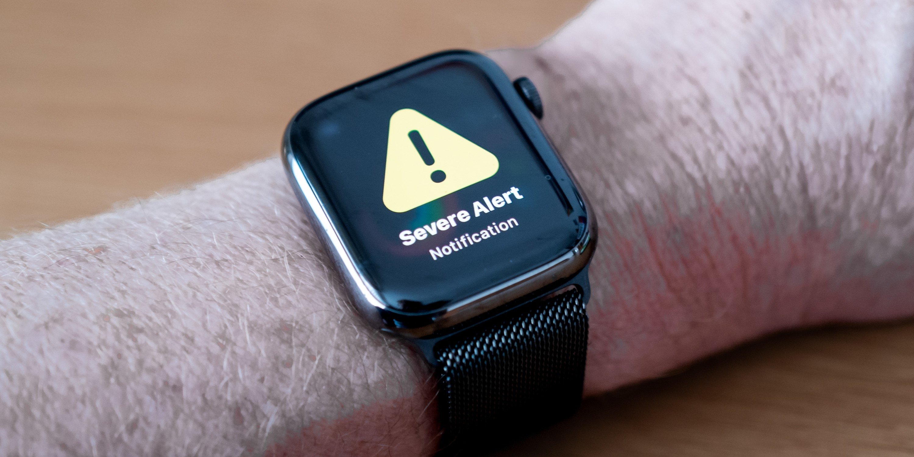 Apple sued for using dangerous 'forever chemicals' in Watch bands